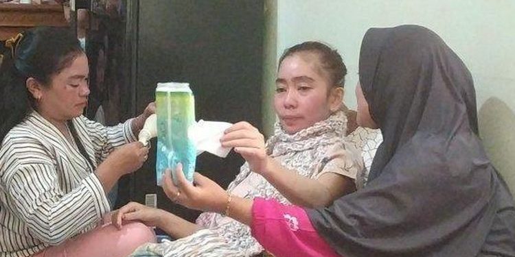 Seorang guru di SMAN 1 Cisolok bernama Susan Antela (31) mengalami kebutaan seusai divaksin Covid-19 (Foto: Tribunjabar.com