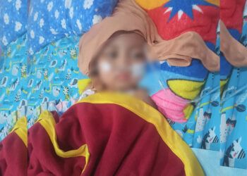 Balita Diduga Dianiaya Ayah Tiri Asal Solok Jalani 3 Kali Operasi, Terkendala Biaya Pengobatan