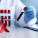 Diskes Riau Temukan 1.170 Kasus HIV pada 2025, LSL Jadi Kelompok Terbanyak