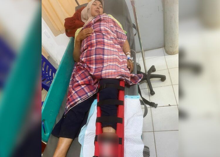 Seorang ibu rumah tangga mengalami patah tulang kaki kiri setelah sepeda motor yang dikendarainya ditabrak kendaraan lain dari arah berlawanan di Jalan Kamboja, Kelurahan Subarang Batuang, Kecamatan Payakumbuh Barat, Payakumbuh, pada Jumat (24/7/2026) sekira pukul 11.00 WIB. Foto: Polres Payakumbuh