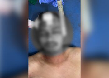 Seorang Pria Ditemukan Penuh Luka Bacok di Gelanggang Pacu Kuda Bukittinggi