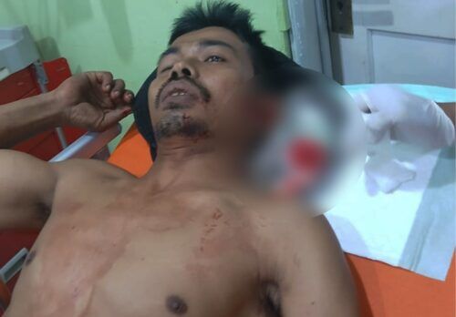 Dibacok di Ladang, Pria di Agam Berlumuran Darah Tiba di Rumah, Istri Lapor ke Polres