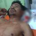 Dibacok di Ladang, Pria di Agam Berlumuran Darah Tiba di Rumah, Istri Lapor ke Polres